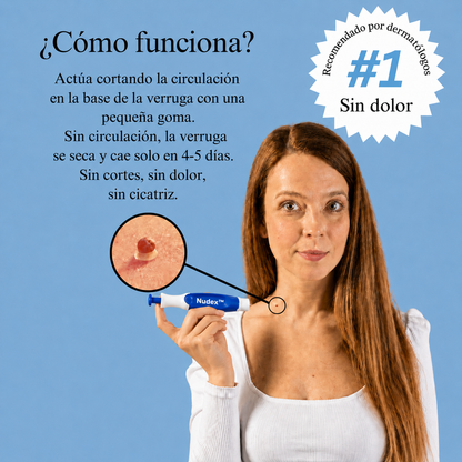 TagBuddy™ Kit — Elimina Verrugas en Casa